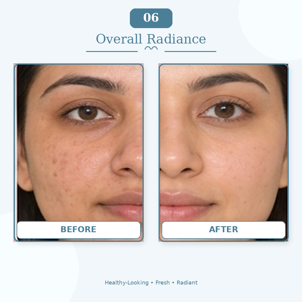 Overall radiance treatment result