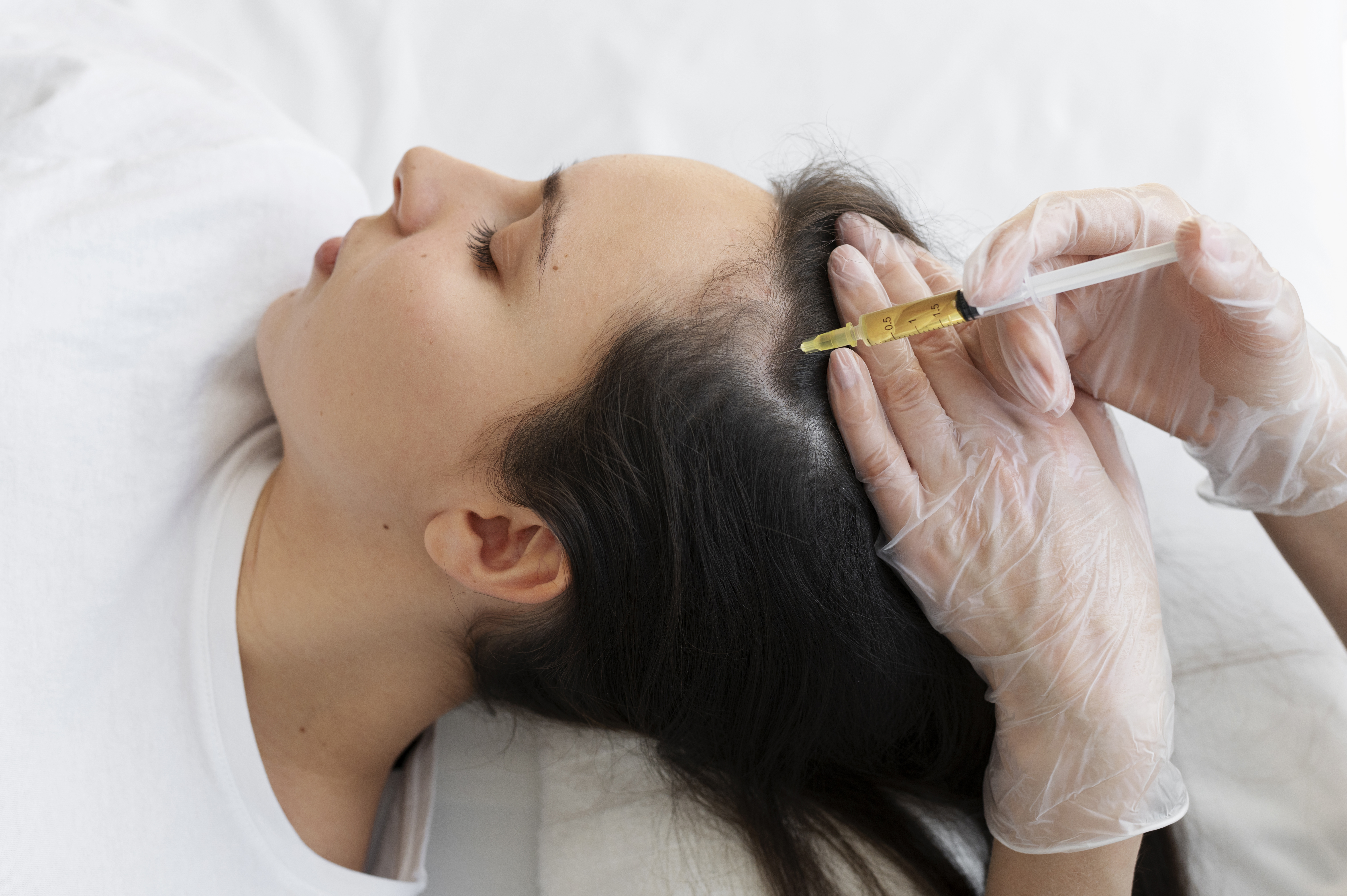 PRP Treatment