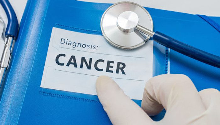 Cancer Diagnosis