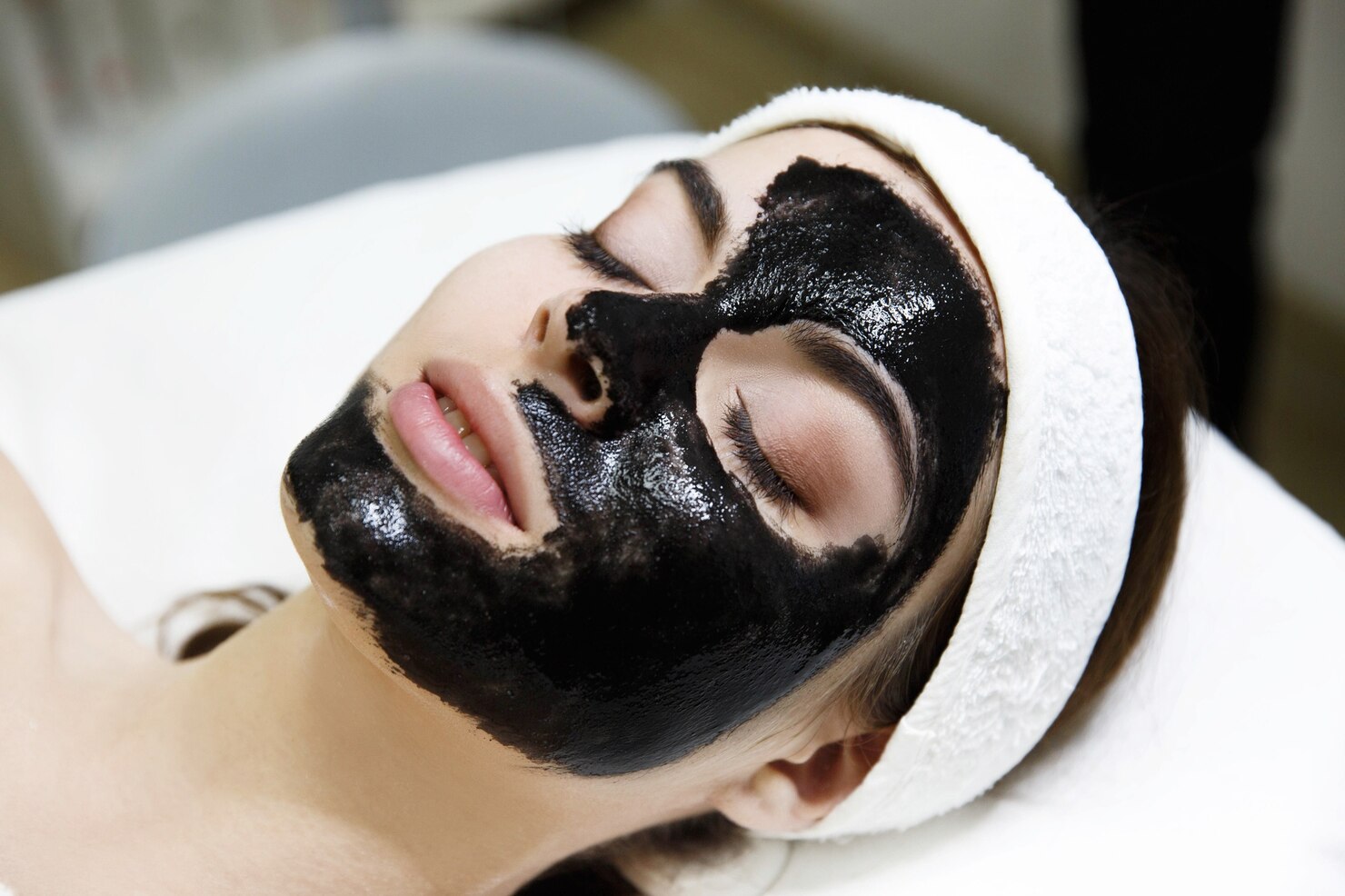 Carbon Laser Facial