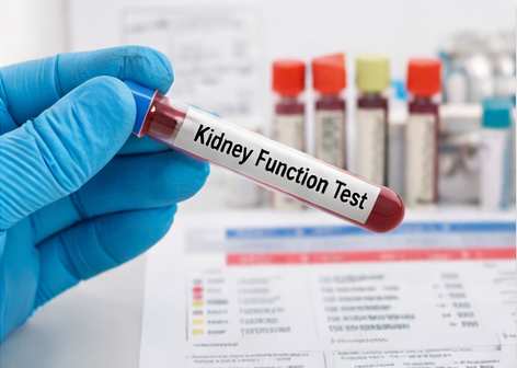 Kidney Function Test