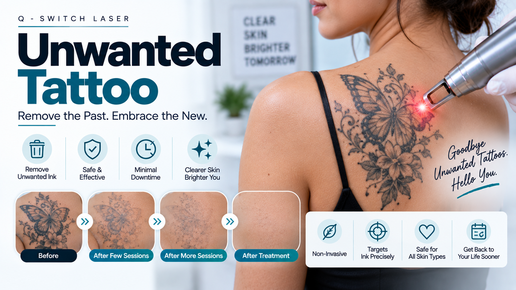 Unwanted Tattoo