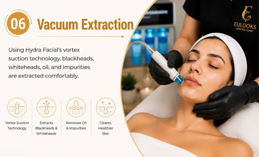 Vacuum Extraction