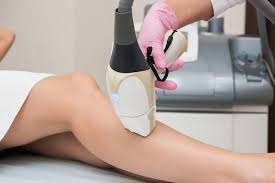 Best Laser Hair Removal Doctor Near Me in Noida