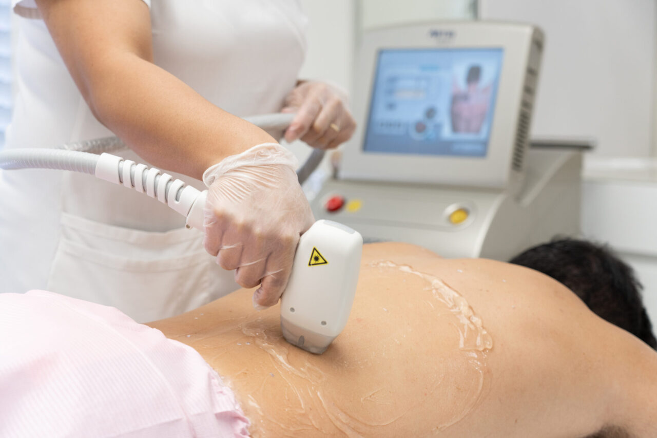 Best Laser Hair Removal Clinic Near Me