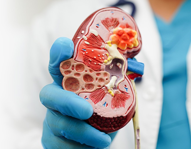Top Rated Nephrologist Clinic in Noida – Complete Kidney Care